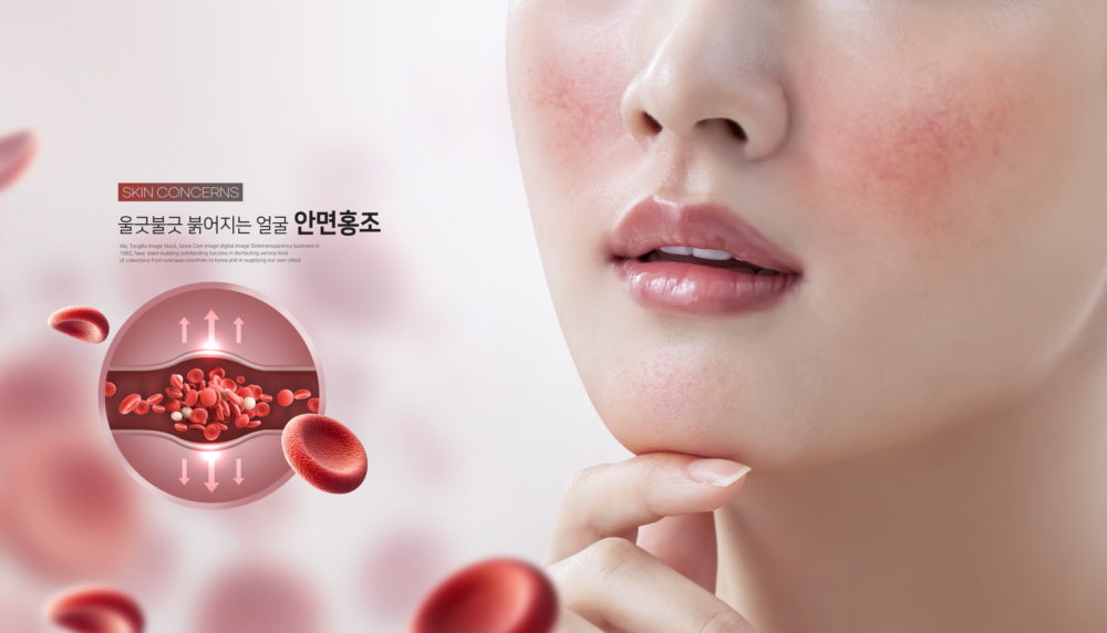 13款皮肤护理保养美容祛痘海报设计PSD模板源文件 Beauty Acne Poster PSD Template_img_2