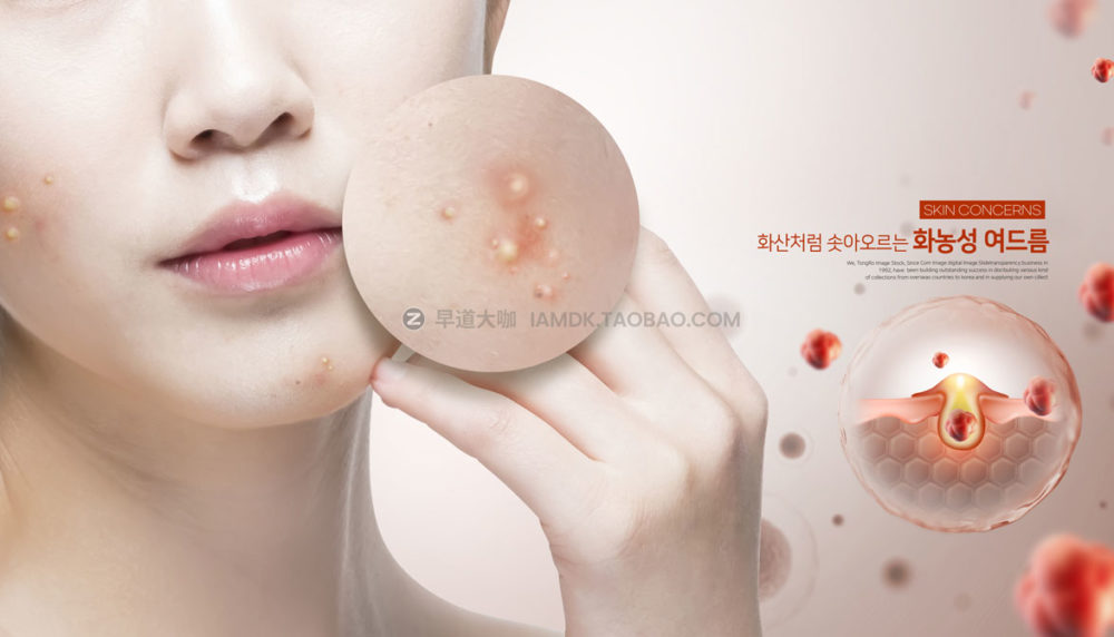 13款皮肤护理保养美容祛痘海报设计PSD模板源文件 Beauty Acne Poster PSD Template_img_2