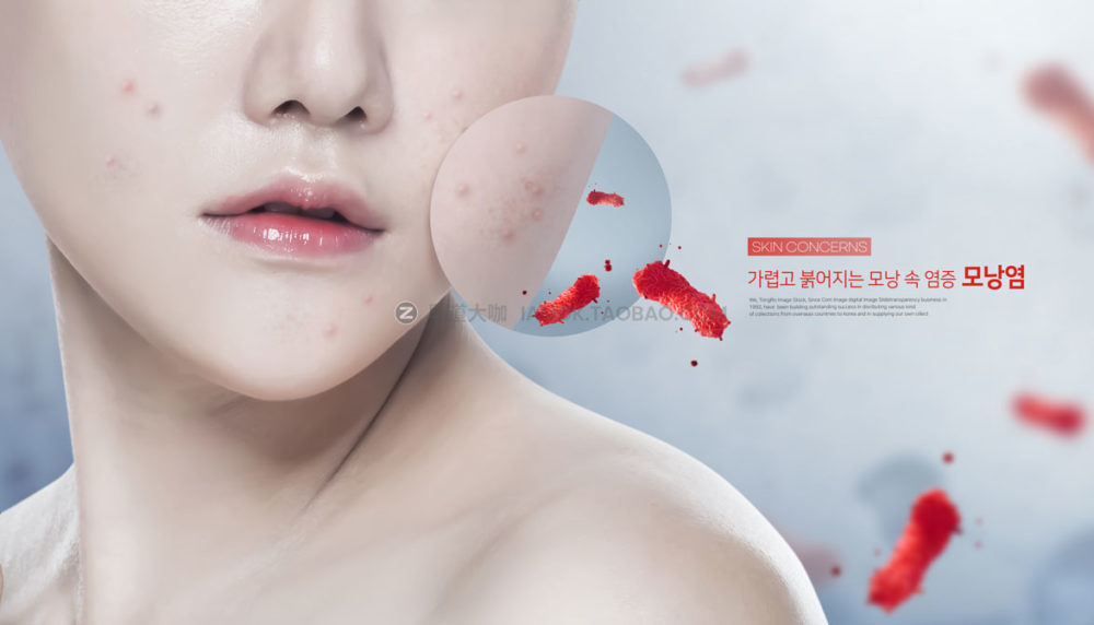 13款皮肤护理保养美容祛痘海报设计PSD模板源文件 Beauty Acne Poster PSD Template_img_2