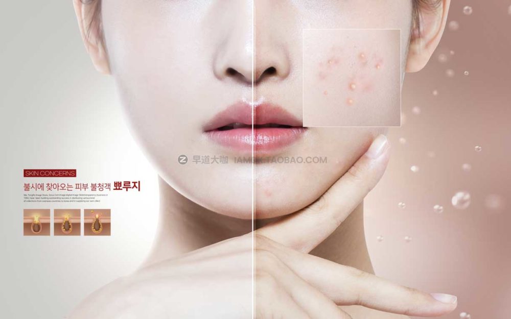 13款皮肤护理保养美容祛痘海报设计PSD模板源文件 Beauty Acne Poster PSD Template_img_2