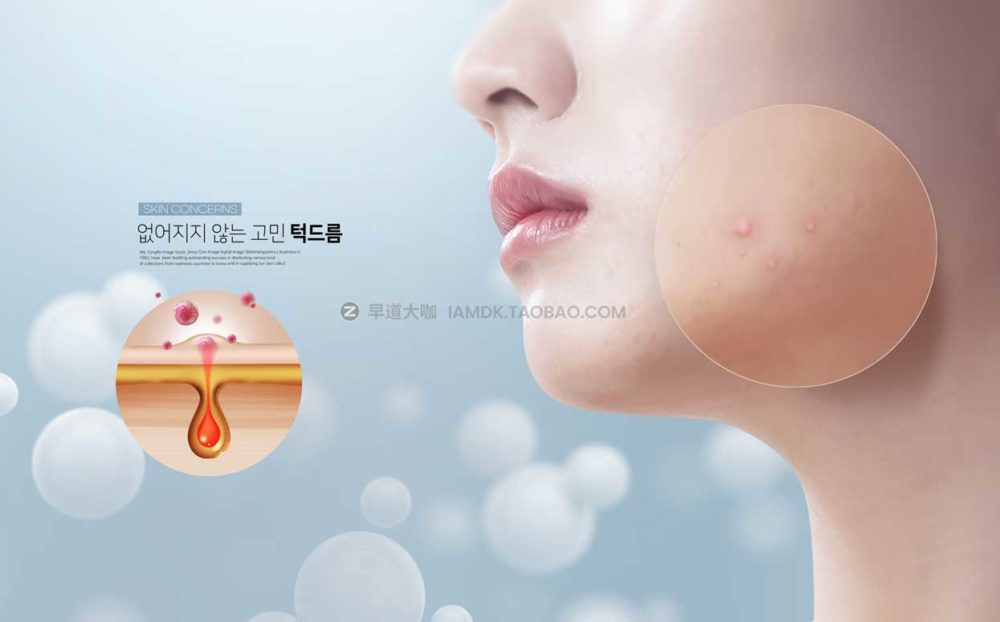 13款皮肤护理保养美容祛痘海报设计PSD模板源文件 Beauty Acne Poster PSD Template_img_2