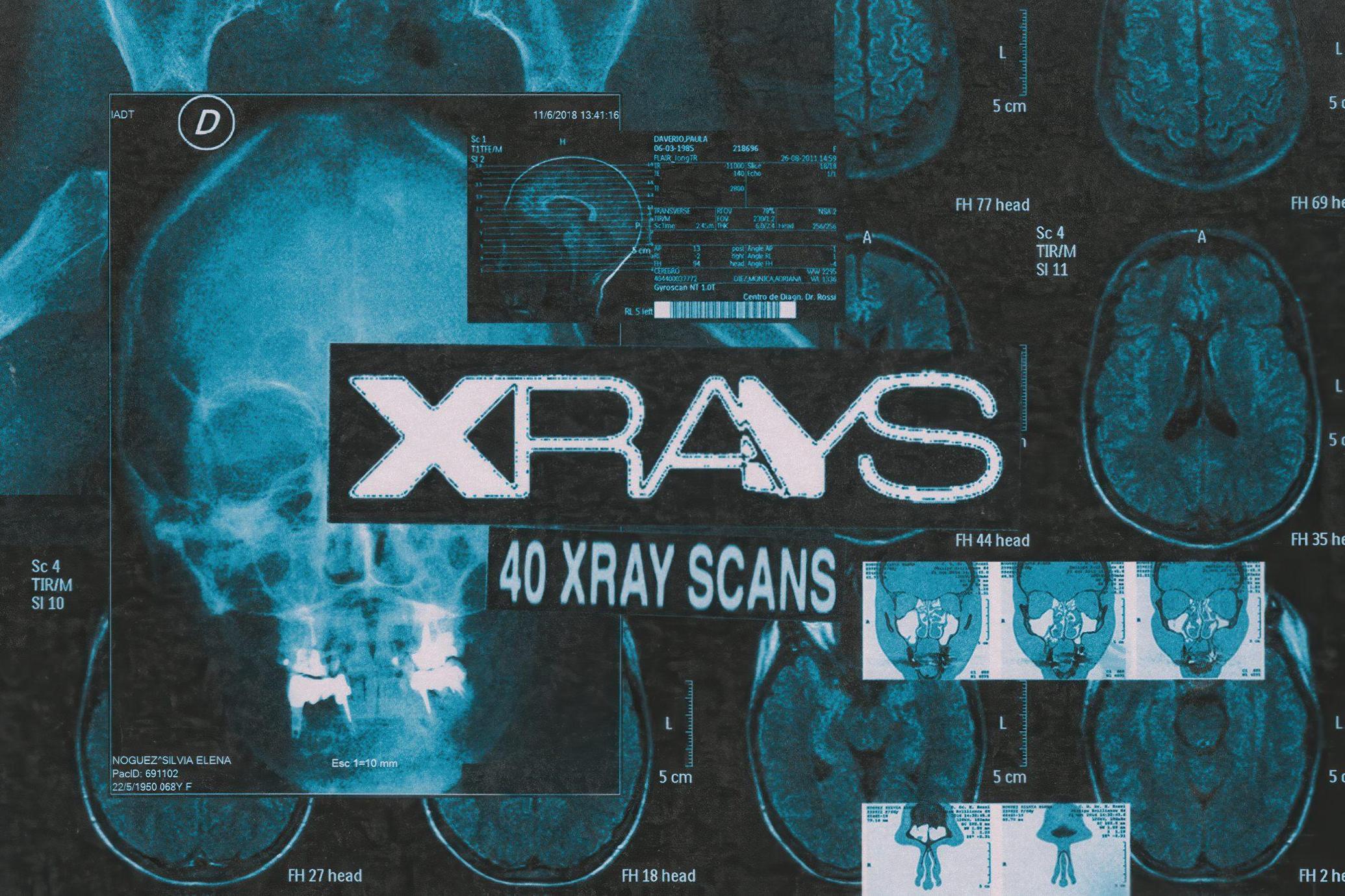 40张前卫艺术暗色医学X光图像数字拼贴素材包 X-Rays Image Pack_nHS4Uz